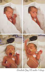 36 Premature Babies Ideas Premature Premature Baby Nicu