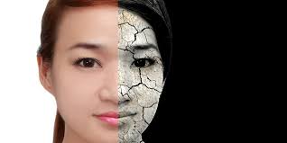 Kamu pernah mengalami kulit kering dan mengelupas di ujung hidung? Kulit Kering Tanda 4 Penyakit Ini Menyerang Tubuhmu Merdeka Com