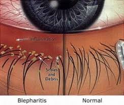 Image result for Blepharis gazensis
