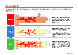 サウナ 頭痛 い