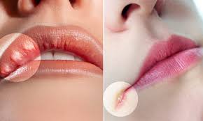 It could be a result of some medical problem but also signifies lip twitching superstition. 10 Things Your Lips Say About Your Health Tingling Lips May Signify A Stroke Is Coming