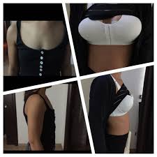 Quanti cc mettere per una seconda abbondante? - Protesi mammarie - Forum |  Estheticon.it