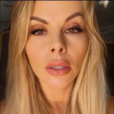 Has anyone regretted not having a brow lift with face and neck lift?