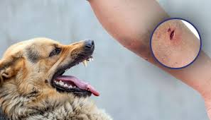 Image result for Dog Bite