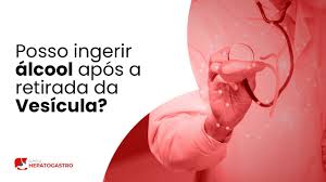 Posso ingerir álcool após a retirada da Vesícula? | Clínica Hepatogastro