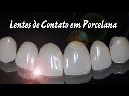Facetas Coltene Passo A Passo Youtube Lentes De Contato Lentes Contatos