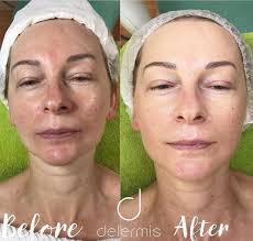 Grace Nardelli (@elegraspa) · Montreal, QC