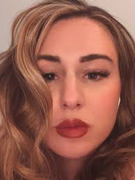 I have nothing against lip filler but if you have a cupids bow (not many  people do) keep it! People are sandblasting beautiful lip structure!