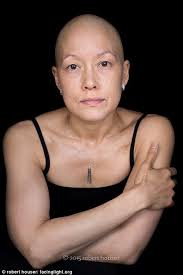 Robert Houser's portraits spotlight cancer patients as they reveal hair  loss and scars