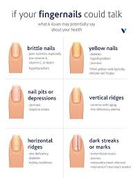 What Your Fingernails Say About Your Health What S Good By V In 2020 Fingernail Health Nail Health Health Signs