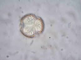 Image result for Colletoecema