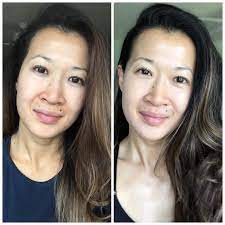 ( 7) zo skin health. How Zo Skin Health Changed My Skin In 28 Days A Beautiful Rawr