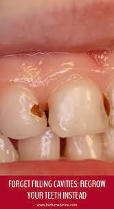 Forget Filling Cavities Regrow Your Teeth Instead Herbal Remedies Natural Teething Remedies Natural Cold Remedies