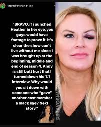 Jen Shah denies giving Heather Gay a black eye! #rhoslc #realhousewives  #saltlakecity #realhousewivesofsaltlakecity #realitytv #jenshah #heathergay  #realitytvdrama #realitytvfights #realitycheck #gossip #bravosnarkside