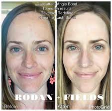 There are some key words in Carlie's testimony. Can you find them? Carlie  didn't have wrinkles yet, but she decided to take care of her skin anyway  and now she looks so