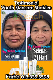 Sebagian produk pemutih gigi menggunakan zat kimia seperti peroksida dan zat asam, yang berisiko menimbulkan gangguan pada kondisi gigi tertentu. Produk Paling Berkesan Untuk Memutihkan Kulit
