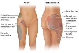 Origins of pains above the hip region any problem that occurs in the reproductive system or gastrointestinal tracts can cause various kinds of illnesses in the hip area, the intensity of the pain may vary this depends on the flank pain is the discomposure in your upper abdomen or sides and back. Two Months Ago I Felt A Pain In My Right Hip It Remains It Doesn T Shoot Down The Leg I Had X Rays A Few Days Ago Could The Pain Be Due To