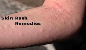 Pin On Health