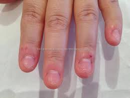 Therefore, we need to pay adequate. Acrylic Nails After New Expression Nails