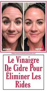 Si Vous Cherchez A Eliminer Les Ridesmais Vous Ne Savez Pas Comment Levinaigre De Cidre Est L Option Sortez Le De Eliminate Wrinkles Beauty Care Beauty Hacks