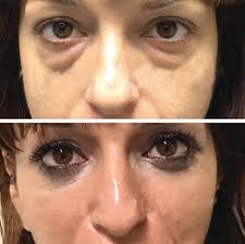 Stem Cell Research, Concepts, and Emerging Technologies