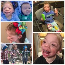 It's #WilliamsWednesday! Meet Anya Jade! She's 5 years old and is in her  2nd year of developmental preschool. She's the only girl in her class and  all the boys love her hair