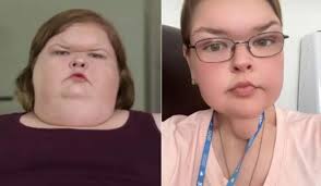 Congratulations🥳🥳!!!! Tammy '1000-Lb Sisters' Skin Removal Surgery Was a  Success, See After Photos(EXCLUSIVE)