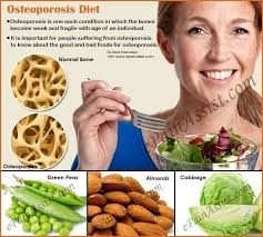 Osteoporosis Diet Good And Bad Foods For Osteoporosis Osteoporosis Diet Osteoporosis Diet