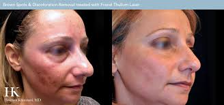 Image result for Skin of Color