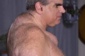 Dr. Pimple Popper's Top Pops: Before-and-After Photos