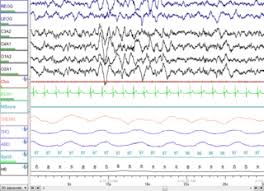 sleep cycle app precise or placebo psychology today