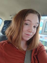 This is Ted Jacobs . He is just starting his battle. He wanted the choice  to take it off, before cancer chose. You win Ted!