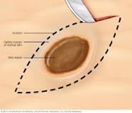Image result