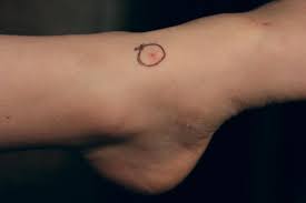 Bug Bites That Look Like Mosquito Bites But Aren T Crazy But True Remedies For Mosquito Bites Bug Bites Remedies Bug Bites