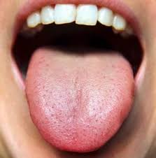 Ayurvedic Tongue Diagnosis Made Easy Wake Up World