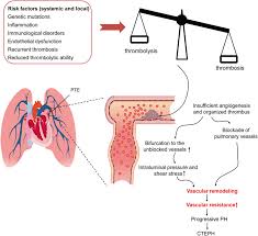 We have now placed twitpic in an archived state. Frontiers In Situ Pulmonary Artery Thrombosis A Previously Overlooked Disease Pharmacology