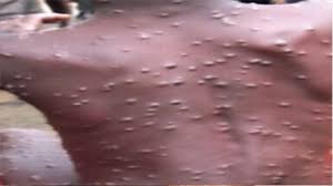 However, the monkey pox virus is much less infectious than the flu. Today Fm Dreaded Monkey Pox Virus Emerges In Akwa Ibom State