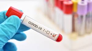 2 blue cross and blue shield of illinois (bcbsil) contracts with prime therapeutics ® to provide pharmacy benefit management and related other services. Covid 19 Independence Blue Cross