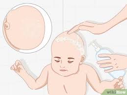 After years of taking hydrochloric acid (hcl) supplements, i switched to using vagal tone and was finally able to stop taking capsules of hcl with. 3 Ways To Stimulate Hair Growth In Children Wikihow Mom