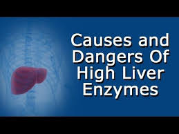 High Liver Enzymes Causes And Dangers Youtube In 2020 High Liver Enzymes Elevated Liver Enzymes Enzymes