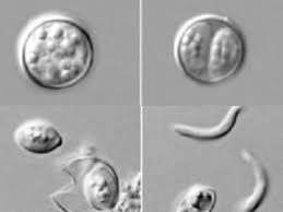 Image result for Cyclospora