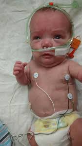 Fundraiser for Jordan Westbrock by Teri Brunsvold : Little Marks Journey