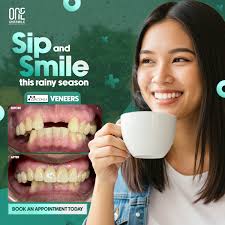 OneSmile Dental Clinic North Edsa