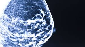 True north imaging (tni) has been performing sonohysterograms since 1994 when dr. Map Car Canadian Association Of Radiologists