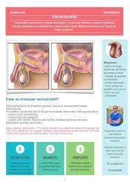 Ma numesc andrei ionut si am o problema cu 1 porumbel care de 3 saptamani schioapata cu un picior. Abcesul Perianal Dr Gabriel Matei I Medic Primar Chirurgie Generala