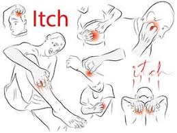 Kratze Scabies Ursachen Symptome Diagnose Behandlung Hausmittel Krank De