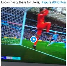 Hugo lloris undergoes surgery on injured elbow. Tottenham Goalkeeper Hugo Lloris Suffers Horror Elbow Injury Photos 9jaflaver
