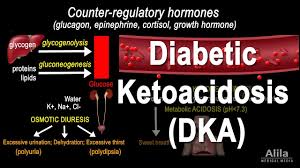 Ketone bodies substrate is free fatty acids from the adipose. Diabetic Ketoacidosis Dka Pathophysiology Animation Youtube