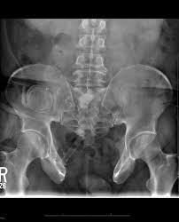 Pin On Radiology Signs