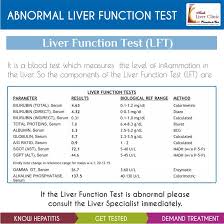 Image result for Liver Function Test